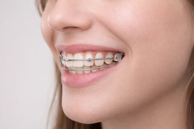 Pekiştirme (Retansiyon) Tedavisi